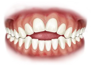 denti