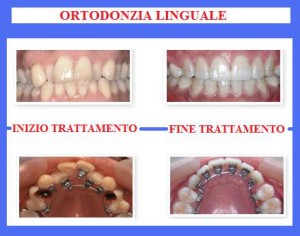 ortodonzia-7