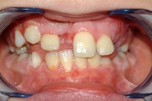 ortodonzia1