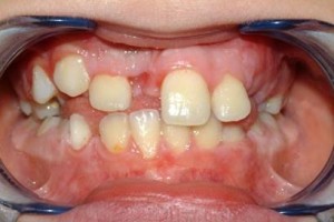 ortodonzia1